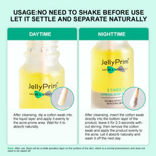 JellyPrim Pimple Acne Spot Treatment Salicylic Acid Acne Drying Lotion   Acne Spot Treatment Care